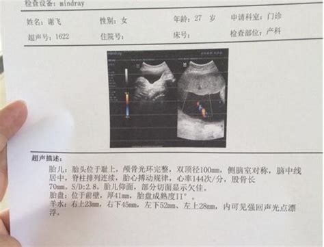 生男寶寶症狀|【好孕到】懷男症狀